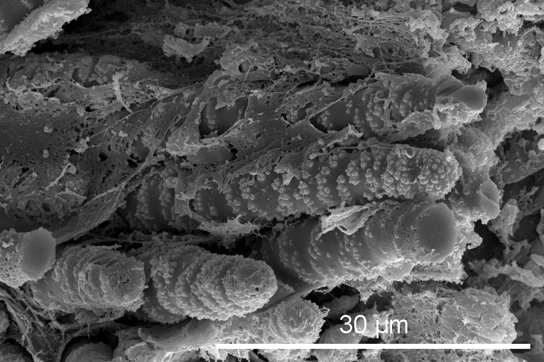 asperspina SEM