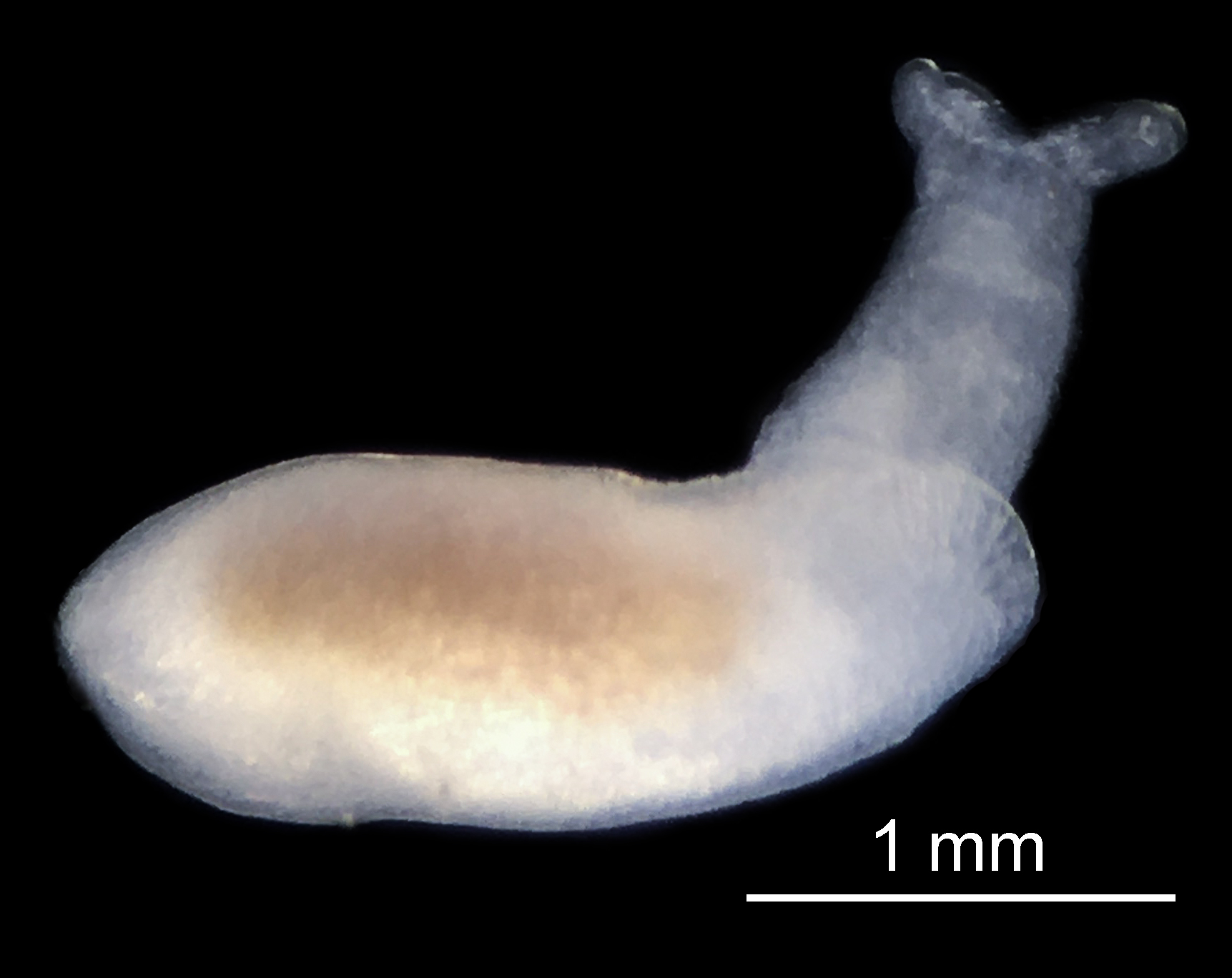 asperspina external