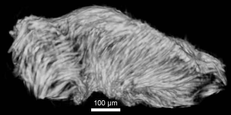 asperspina microCT1