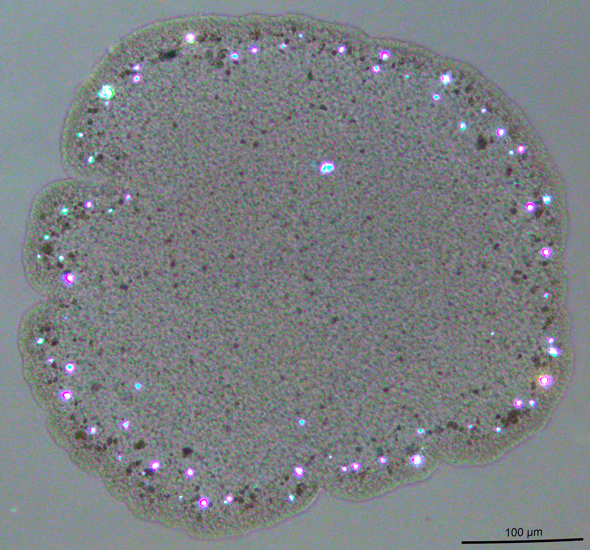 trichoplax